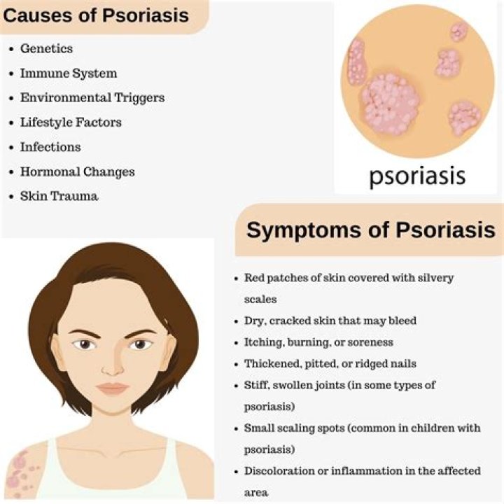 Can you catch psoriasis skin disease?