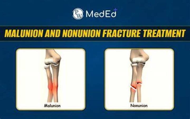 Can you fix a malunion?