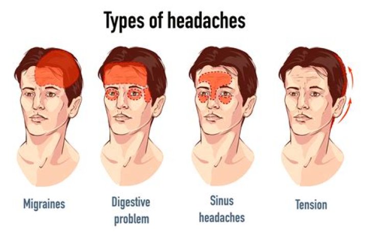 Could cataracts cause headaches?