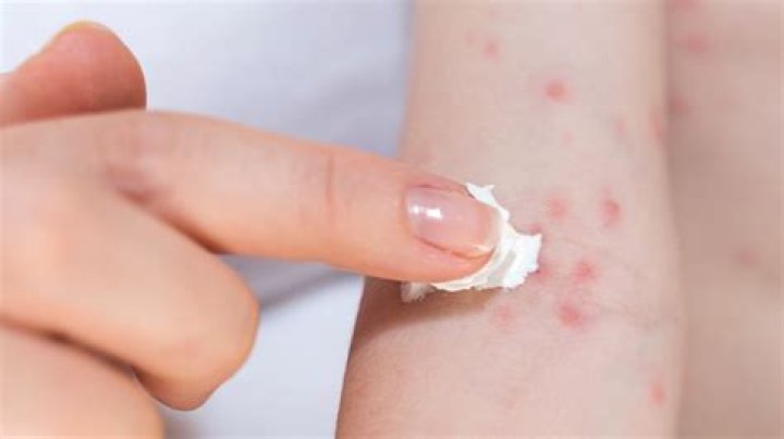 Could i be allergic to my soap?