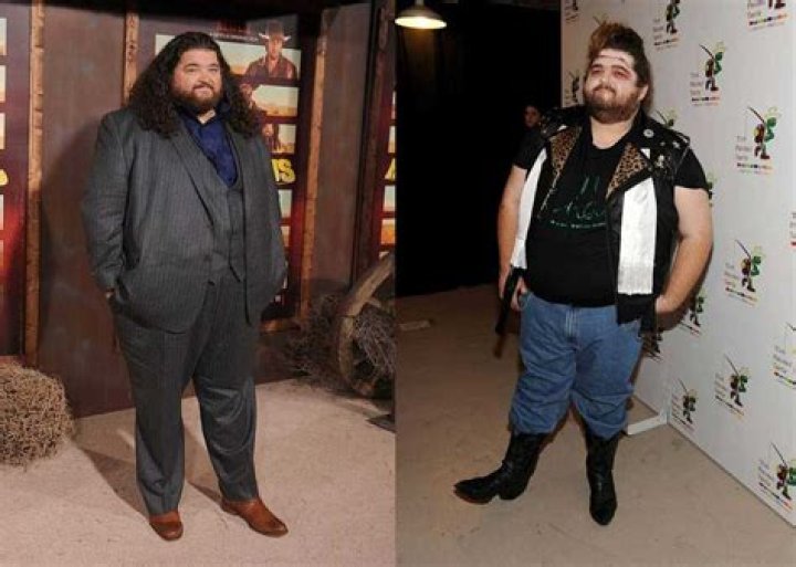 Did hurley lose weight?