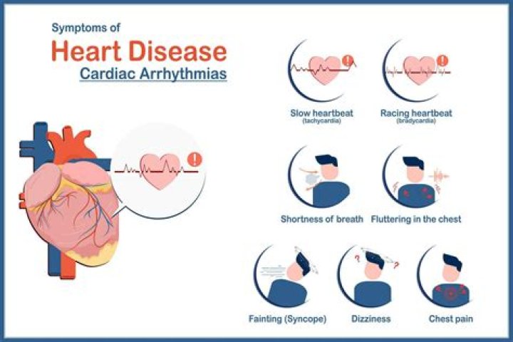 Does bradycardia cause headaches?
