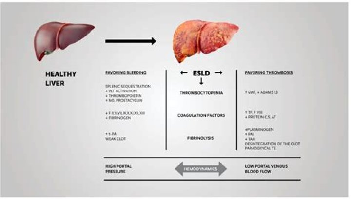 Is cirrhosis a hypercoagulable state?