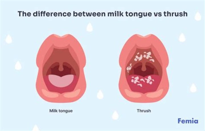 Is milk residue on tongue?