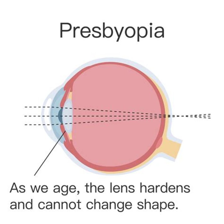 Is presbyopic a word?