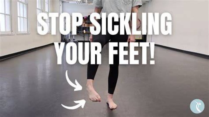 What does a sickled foot mean?