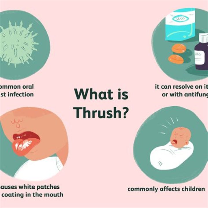 What does having thrush mean?