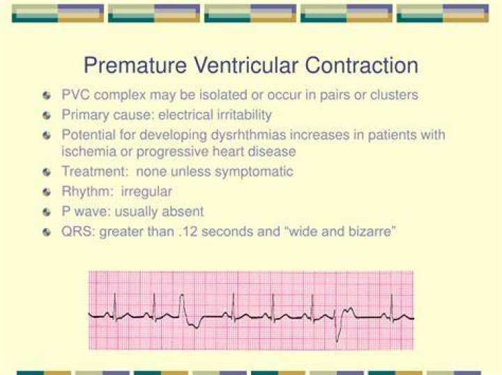 What is premature ventricular contractions?