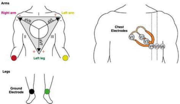 Why are inactive electrodes used?