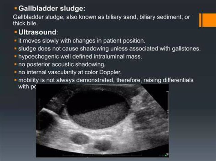 Will endoscopy show gallbladder problems?